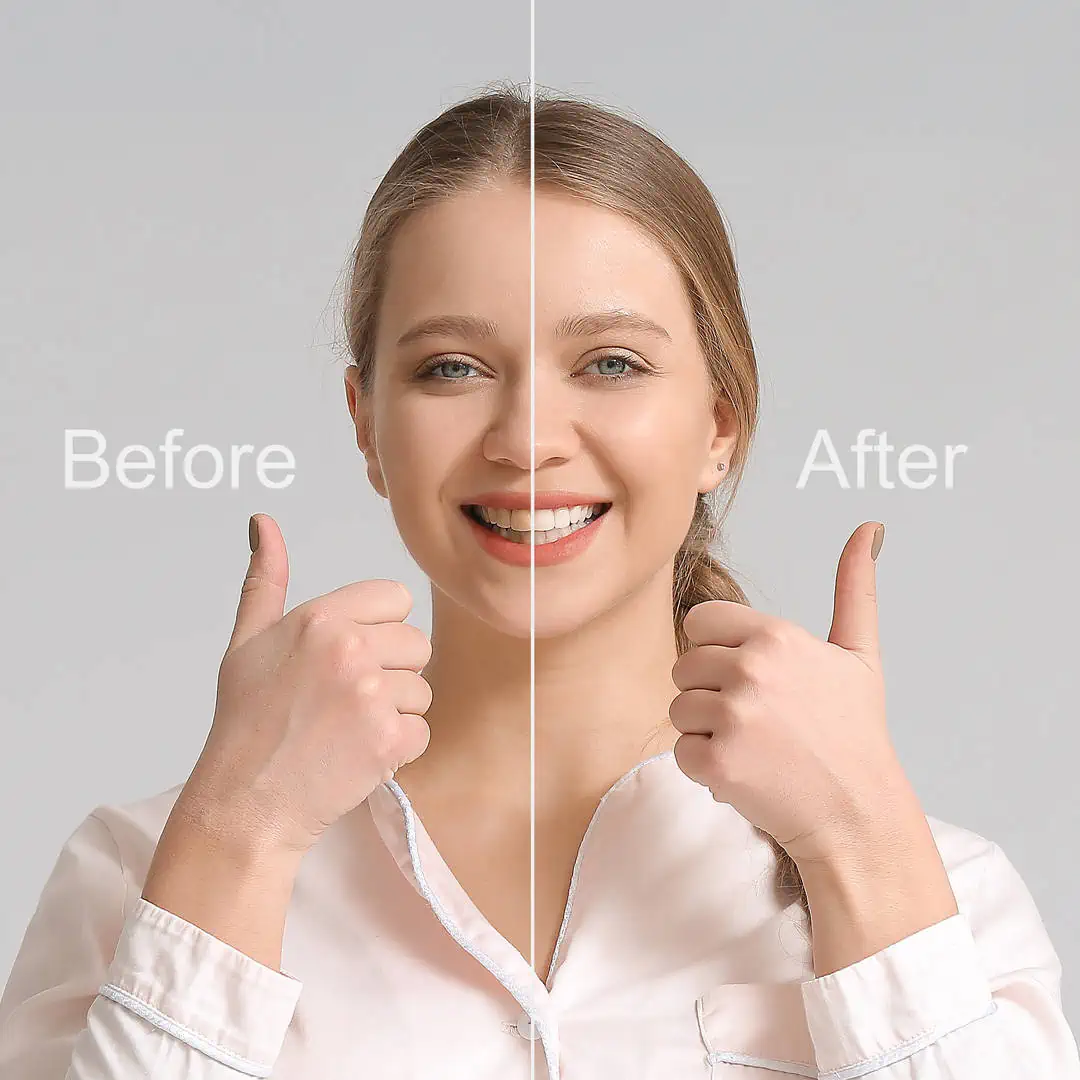 Dentist showing a patient before and after smile photos